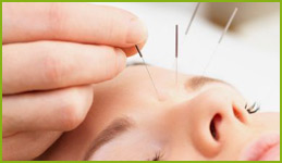 Acupuncture