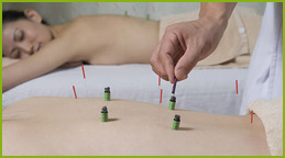 Acupuncture therapy